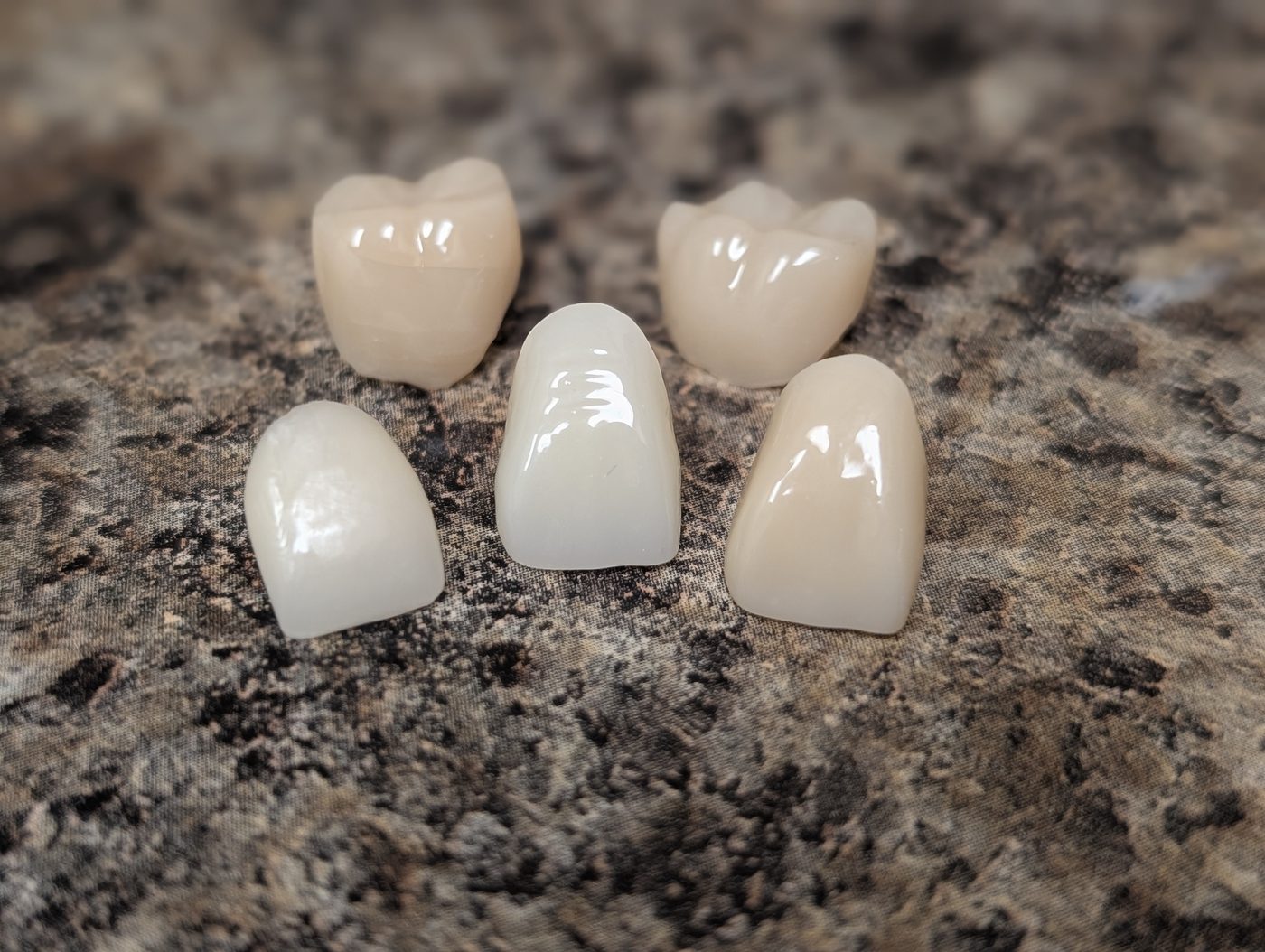 Close up of custom milled ceramic crowns at Precise Dental